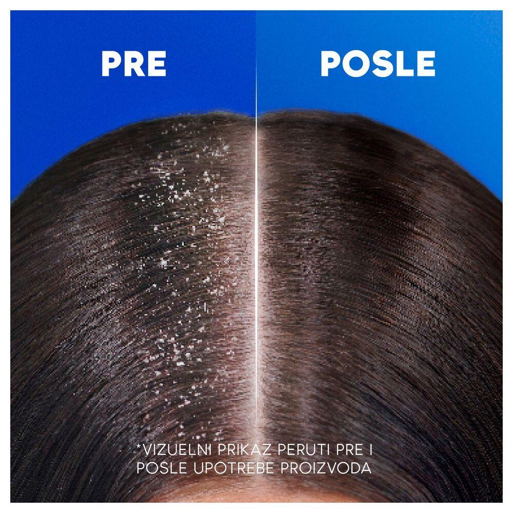 head shoulders classic 250ml